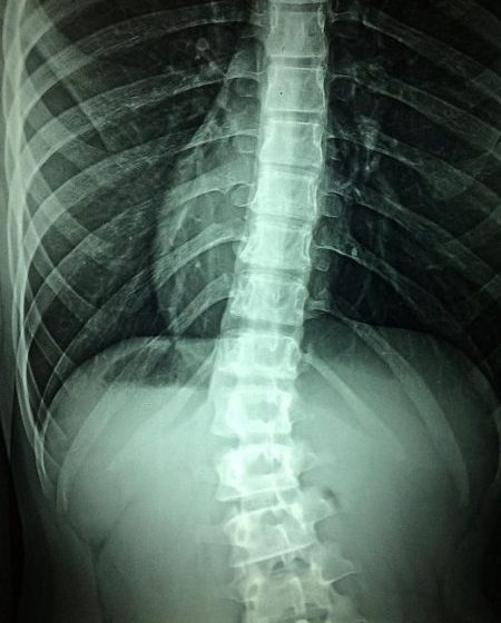 x-rays-hospital-disability-doctor-patient-care-spinal-cord-illness-clinic